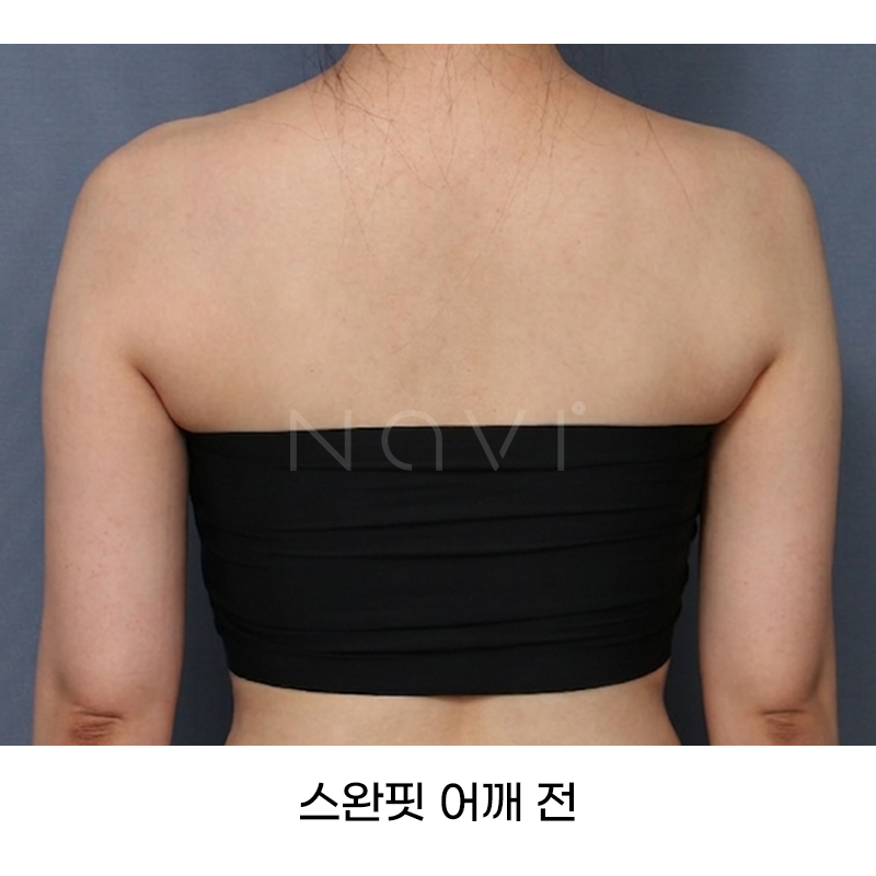 Before 8 Front