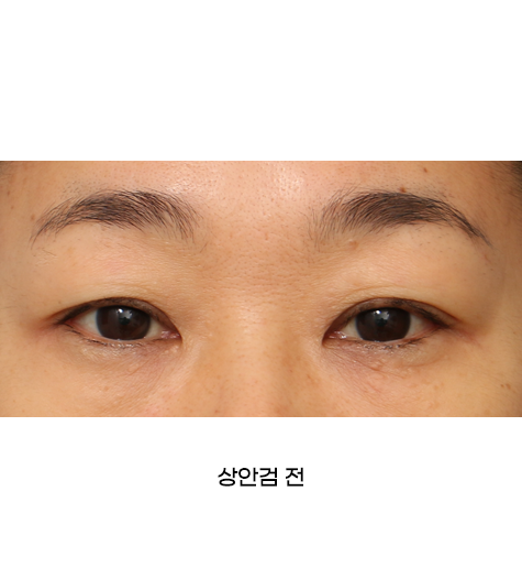 Before 9 Front
