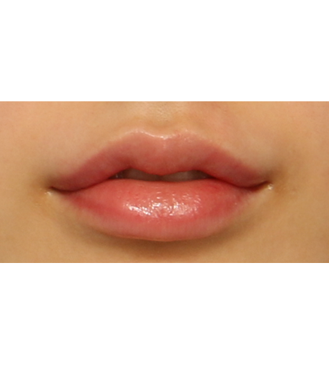 Before 8 Front