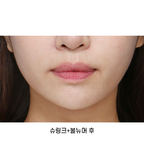 Before 9 Front