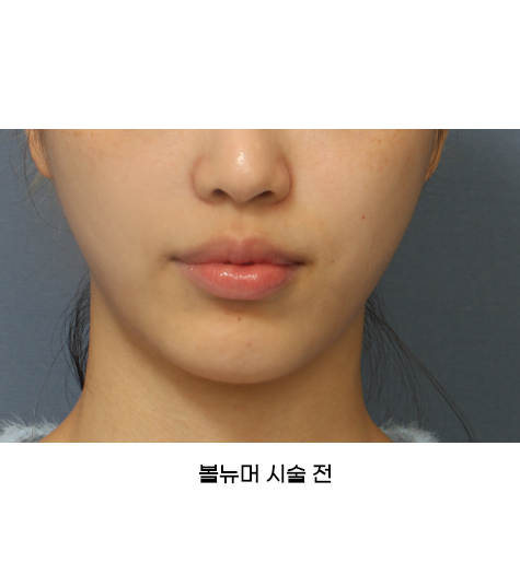 Before 9 Front