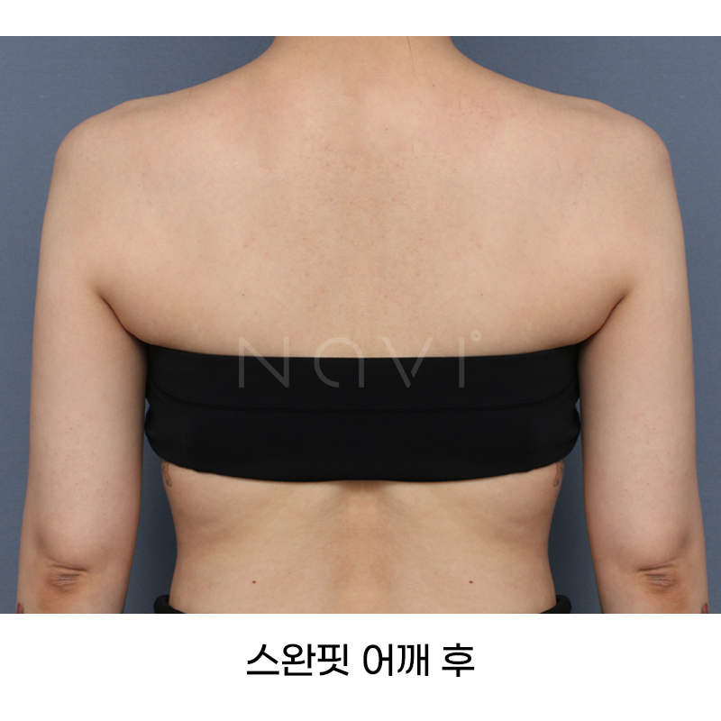 Before 8 Front