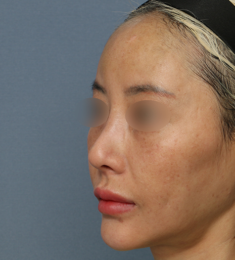 Before 11 45 Degrees