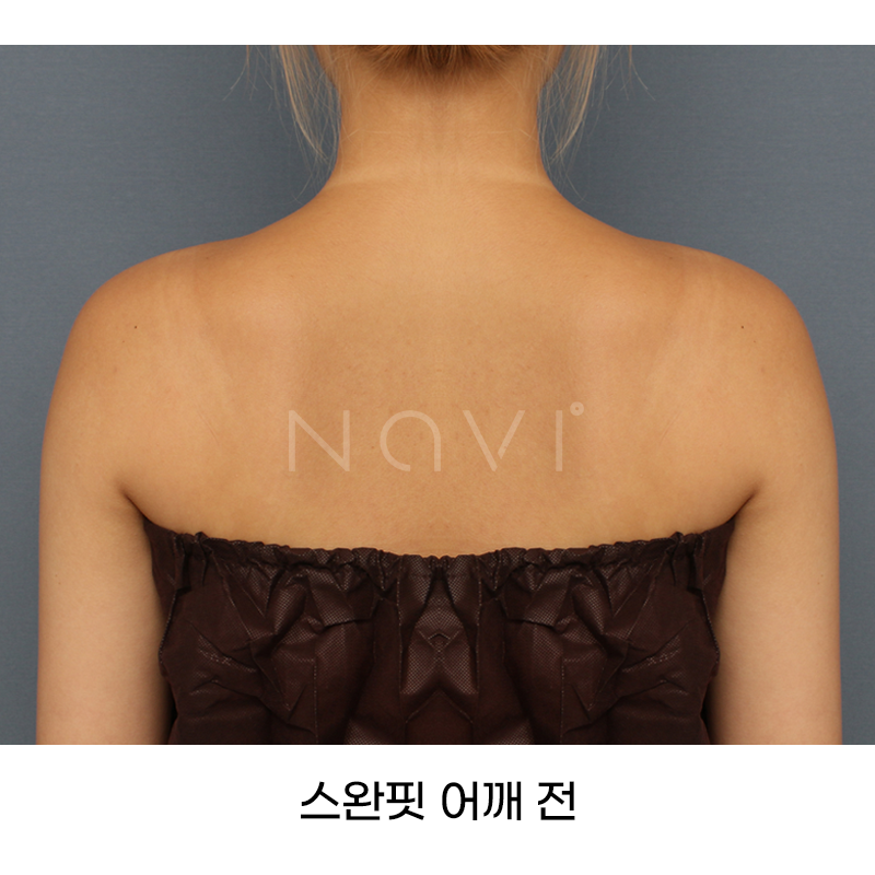Before 5 Front