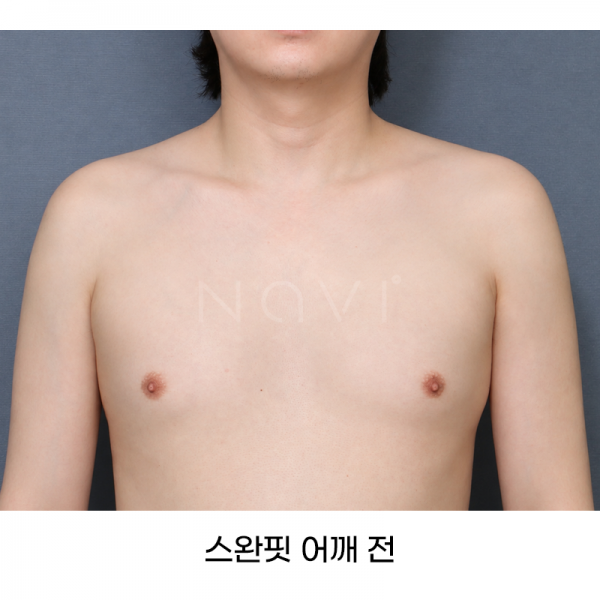 스완핏 어깨